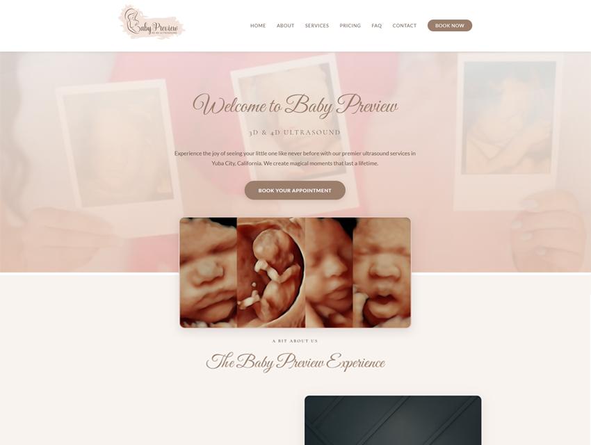 Baby Preview 3D/4D Ultrasound